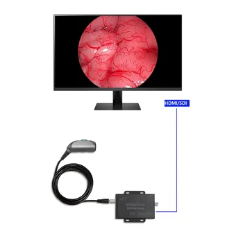 Kaasaskantav ENT 4K Meditsiini Endoscope Ühik Endoskoopia Süsteemi Video Protsessor